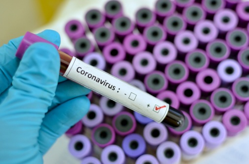 AXA-XL-advisory-on-the-coronavirus